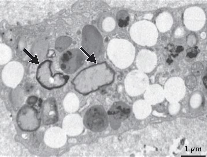 Microplastics